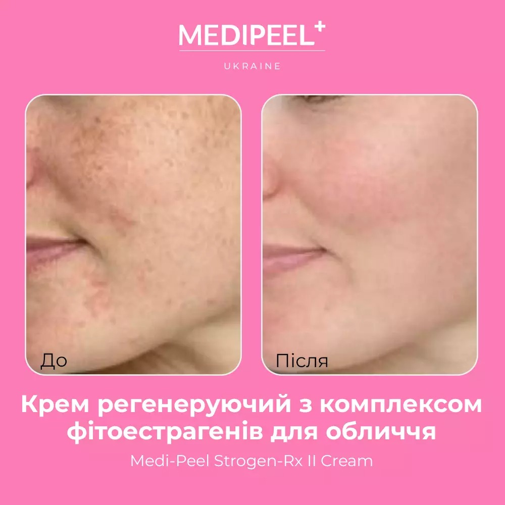 Крем для обличчя Medi-Peel Strogen-Rx II Cream регенерувальний з комплексом фітоестрогенів 30 мл - фото 3