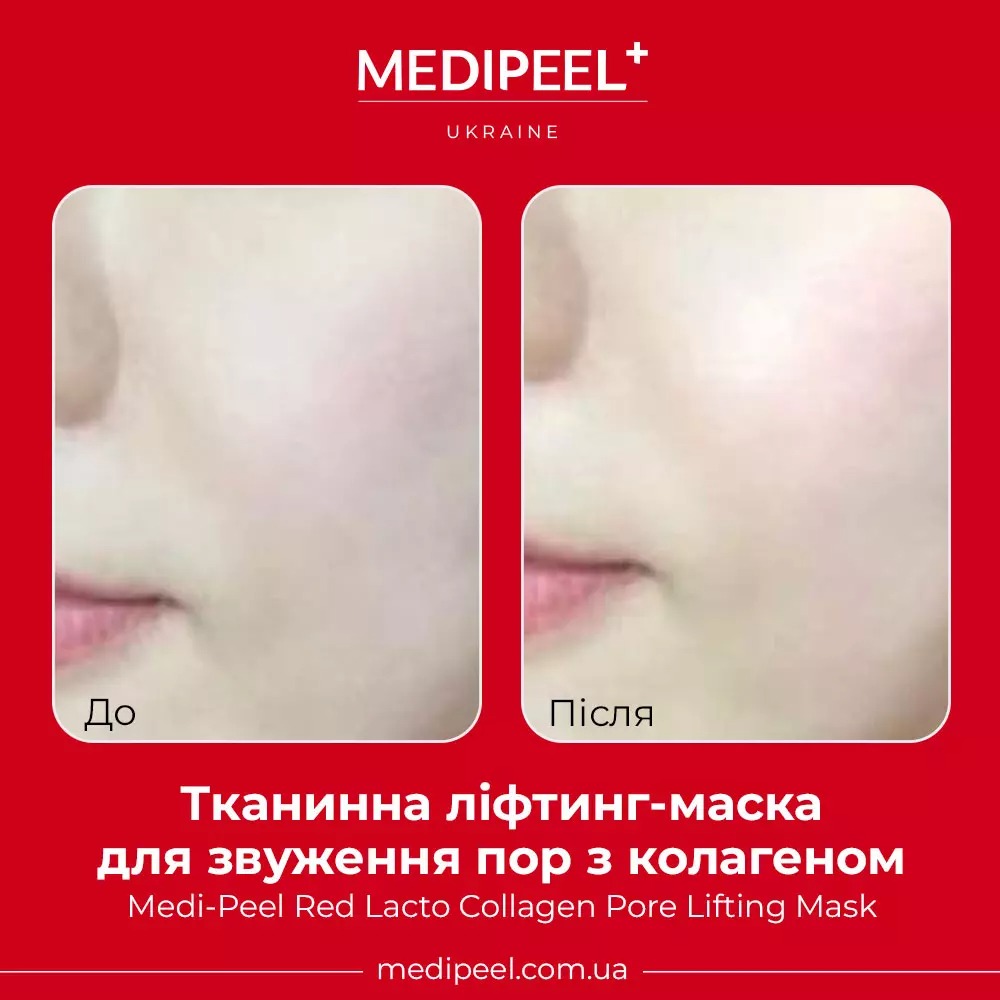 Тканинна ліфтинг-маска Medi Peel Red Lacto Collagen Pore Lifting Mask для звуження пор з колагеном 30 мл - фото 2