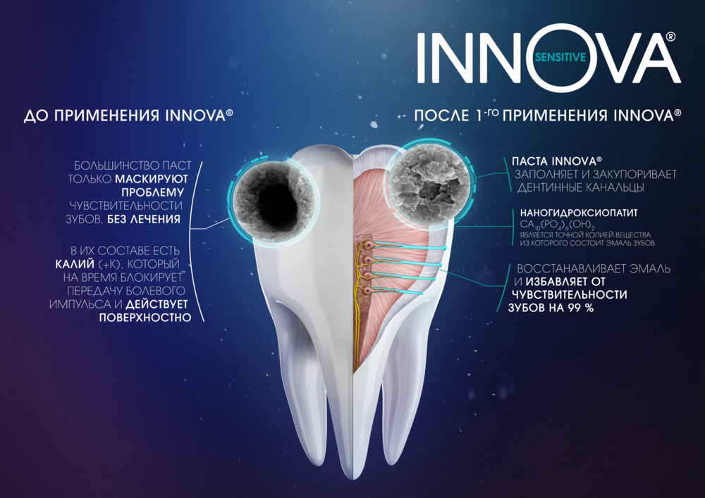 Зубна паста Splat Innova Sensitive Відновлення емалі і здоров'я ясен 75 мл - фото 5