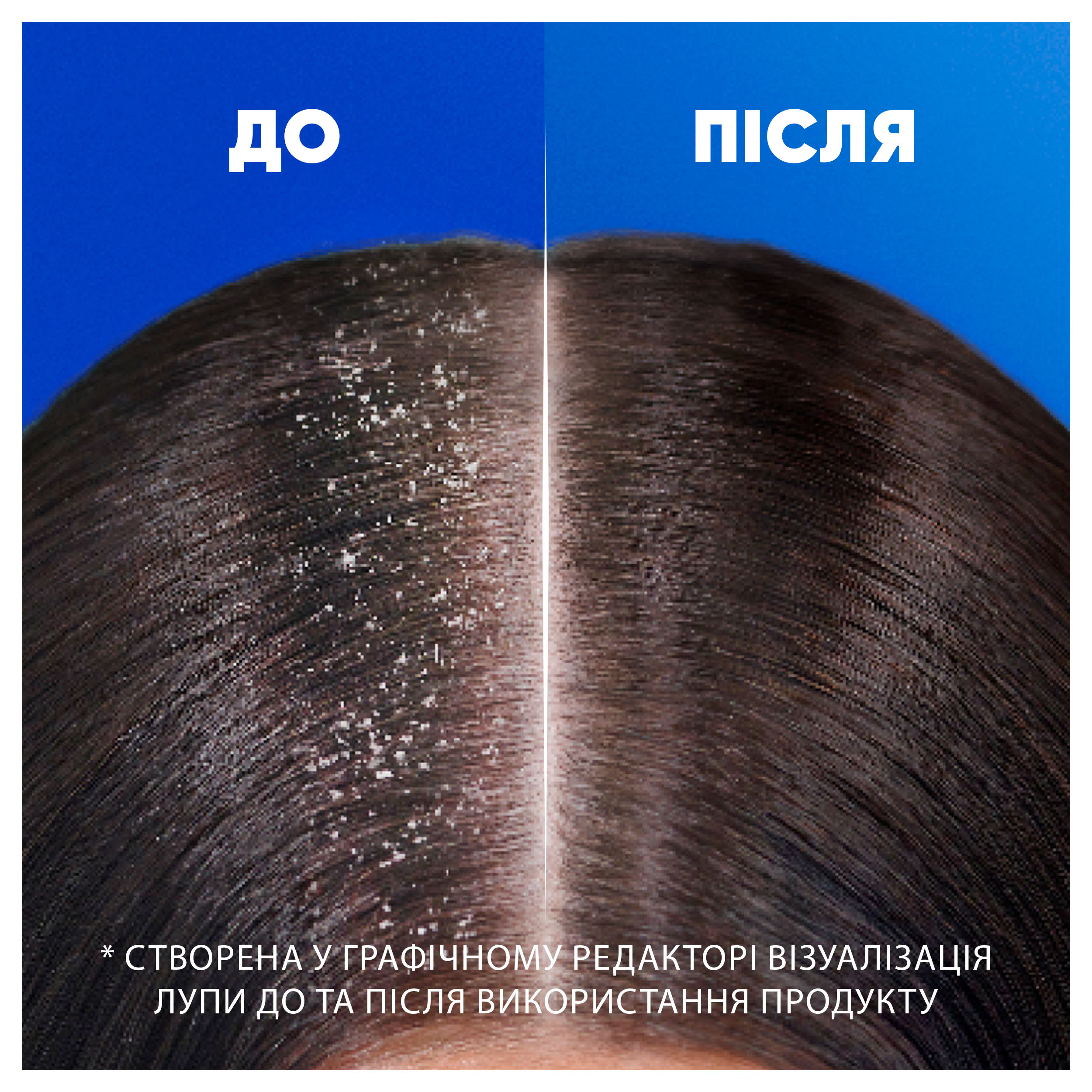 Шампунь против перхоти Head & Shoulders Глубокое увлажнение 250 мл - фото 2