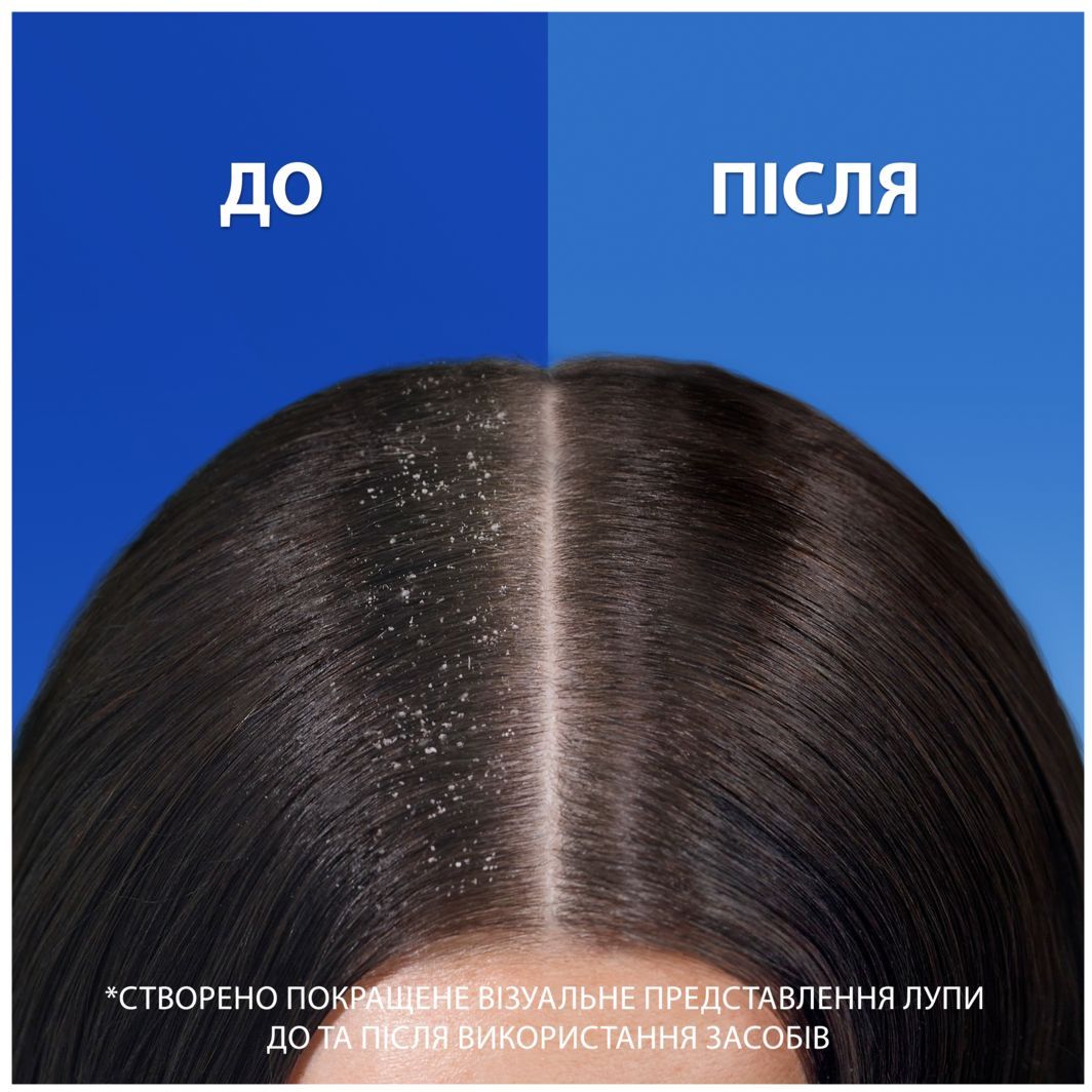 Шампунь та бальзам-ополіскувач проти лупи Head&Shoulders Основний догляд, 2 в 1, 540 мл - фото 4