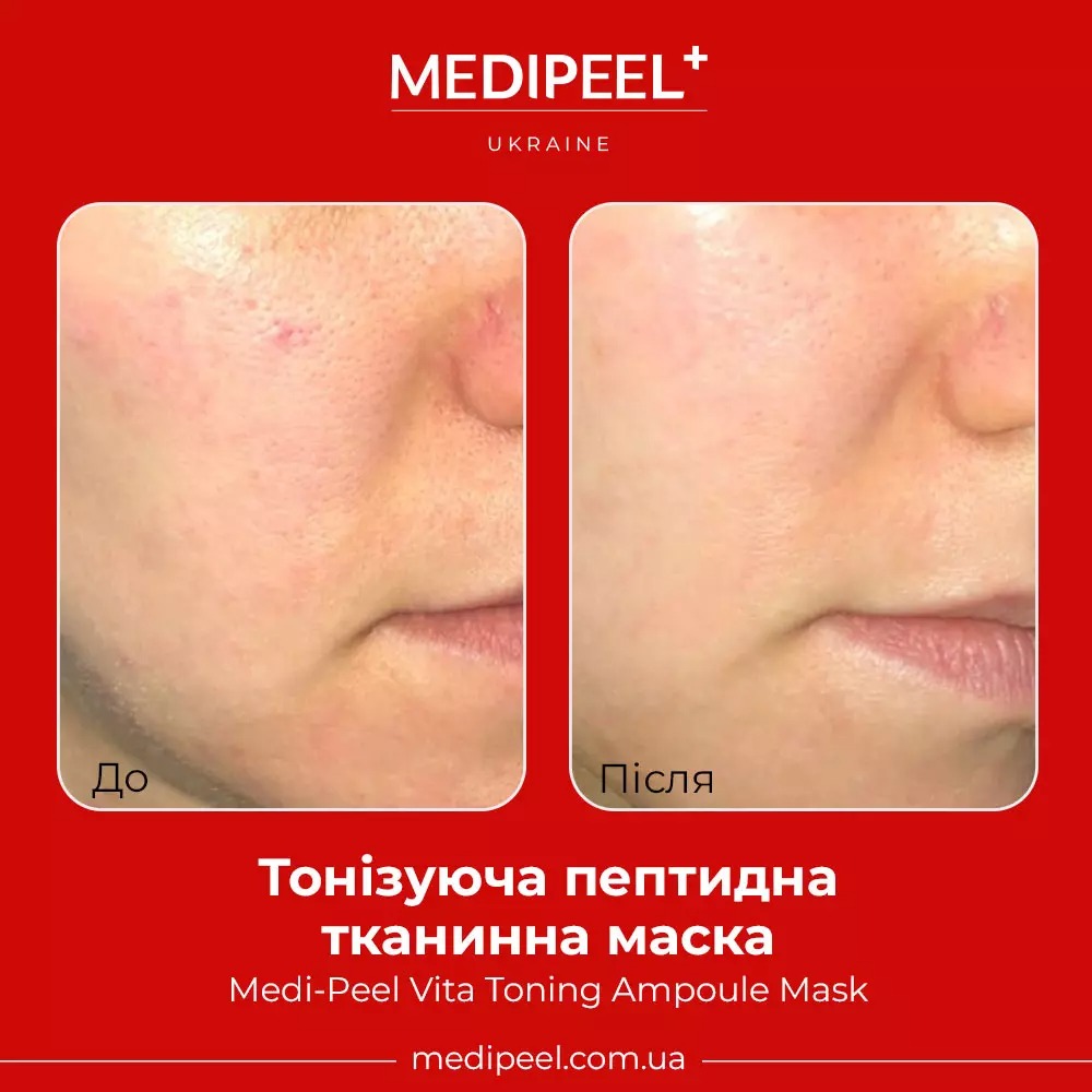 Тканинна маска для обличчя Medi-Peel Vita Toning Ampoule Mask тонізувальна ампульна 30 мл - фото 3