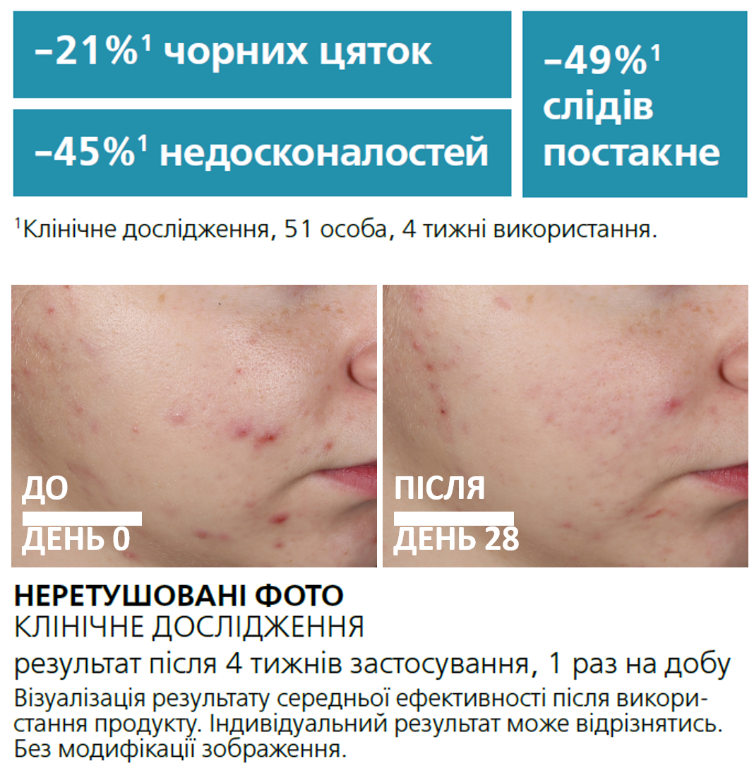 Ультраконцентрована сироватка La Roche-Posay Effaclar з ефектом пілінгу для жирної проблемної шкіри 30 мл - фото 9