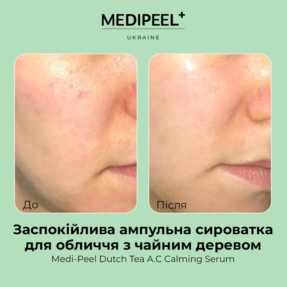 Сироватка ампульна для обличчя Medi-Peel Dutch Tea AC Calming Serum з чайним деревом 70 мл - фото 4