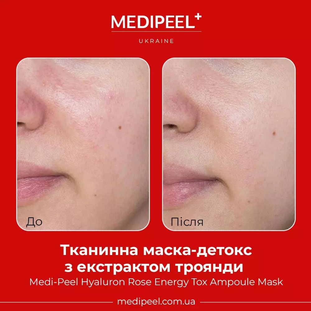 Тканинна маска-детокс Medi-Peel Hyaluron Rose Energy Tox Ampoule Mask з екстрактом троянди 30 мл - фото 4