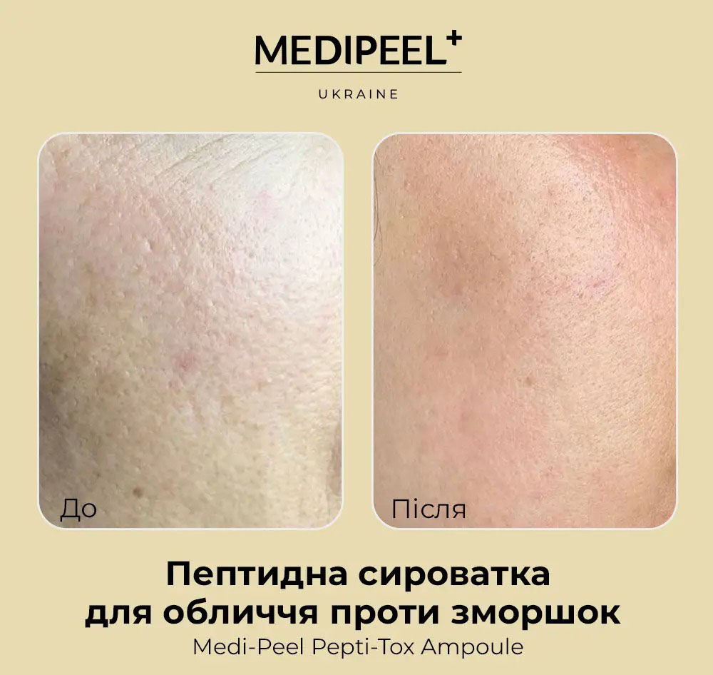 Сироватка для обличчя Medi-Peel Pepti Tox Ampoule пептидна антивікова розгладжуюча 30 мл - фото 4