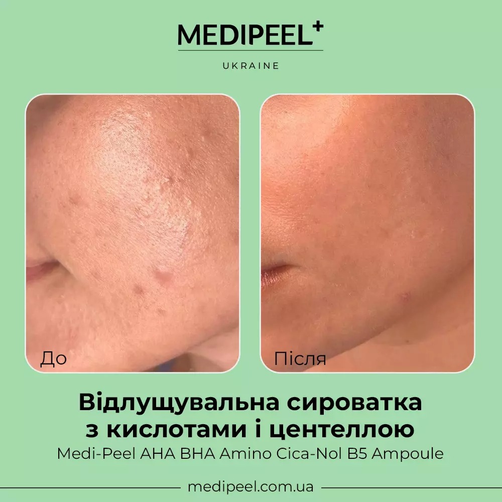 Сироватка для обличчя Medi-Peel AHA BHA Amino Cica-Nol B5 Ampoule відлущувальна 30 мл - фото 4