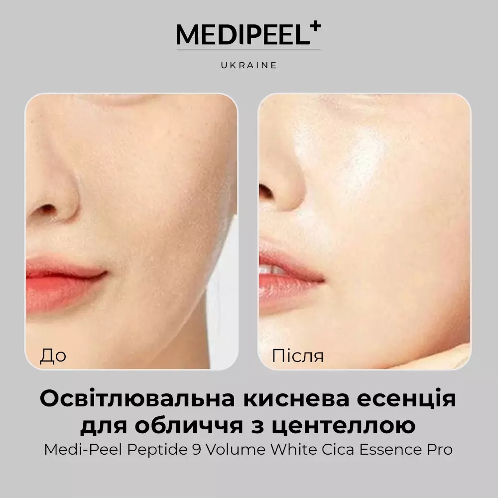 Эссенция для лица Medi-Peel Peptide 9 Volume White Cica Essence Pro осветительная кислородная с центеллой 100 мл - фото 5