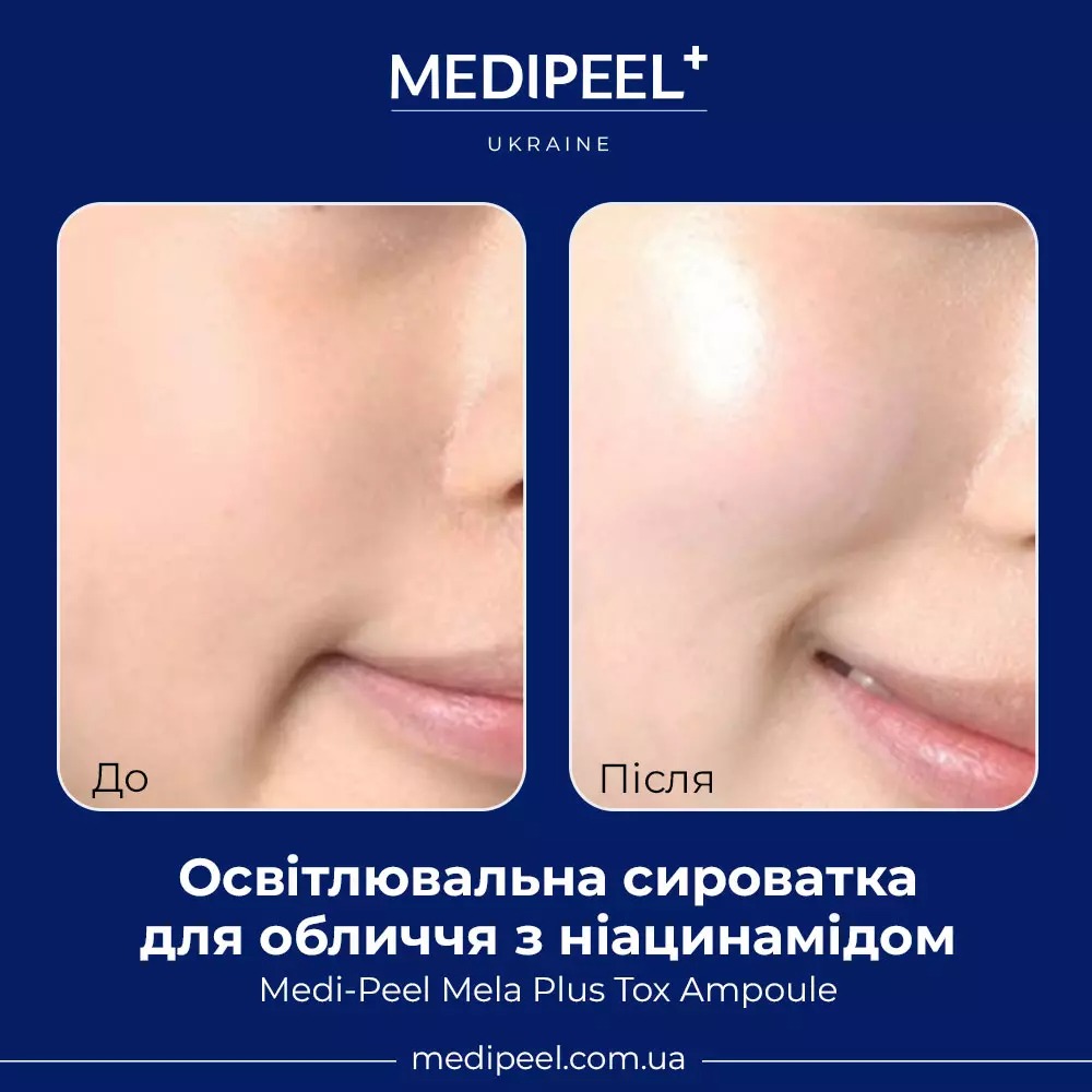 Сироватка для обличчя Medi-Peel Mela Plus Tox Ampoule освітлювальна з ніацинамідом 35 мл - фото 4