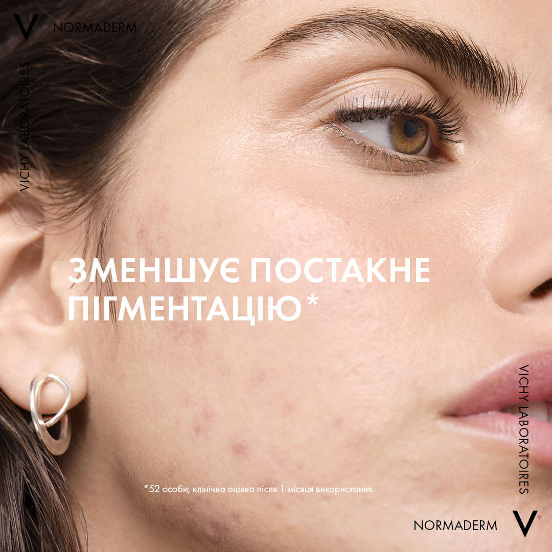 Очищающий гель-сыворотка Vichy Normaderm с эффектом пилинга для проблемной кожи лица и тела 125 мл - фото 6