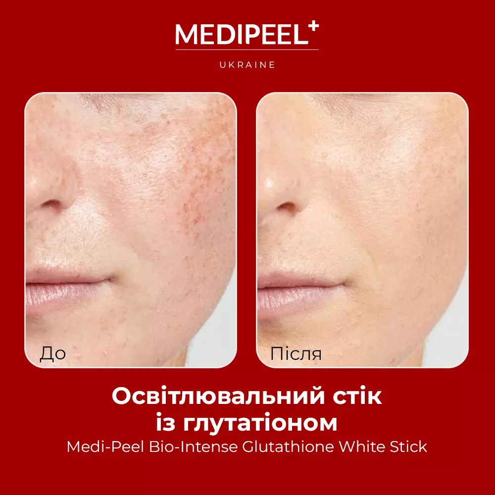 Освітлювальний стік із глутатіоном Medi Peel Bio-Intense Glutathione White Stick 10 г - фото 4