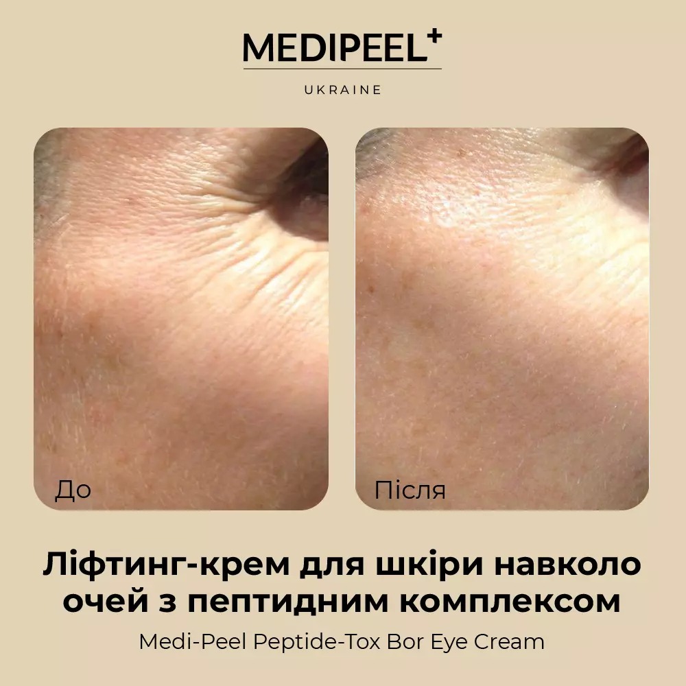 Лифтинг крем для кожи вокруг глаз Medi-Peel Peptide-Tox Bor Eye Cream с пептидным комплексом 40 мл - фото 5