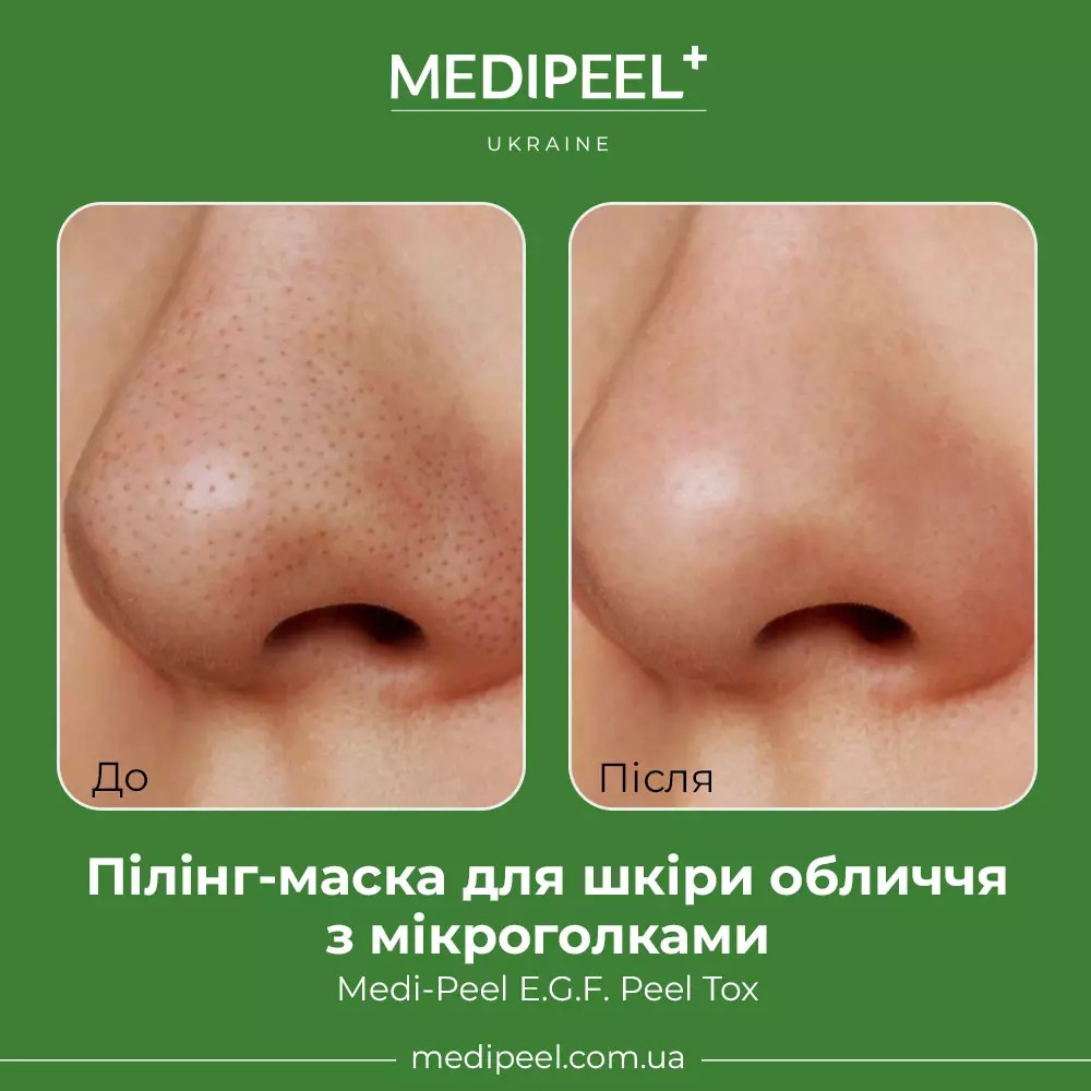 Пилинг-маска для кожи лица Medi-Peel EGF Peel Tox с микроиглами 70 г - фото 2