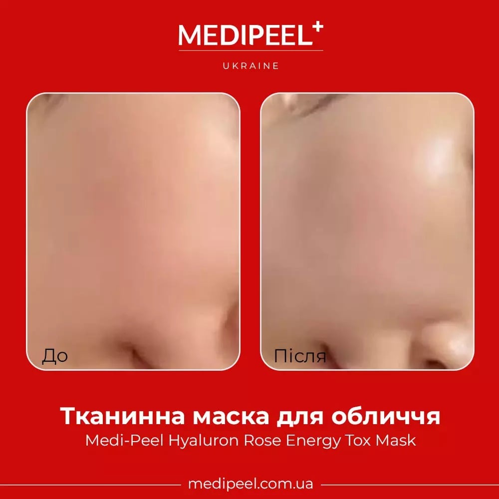 Тканинна маска для обличчя Medi-Peel Hyaluron Rose Energy Tox Mask 30 мл - фото 2