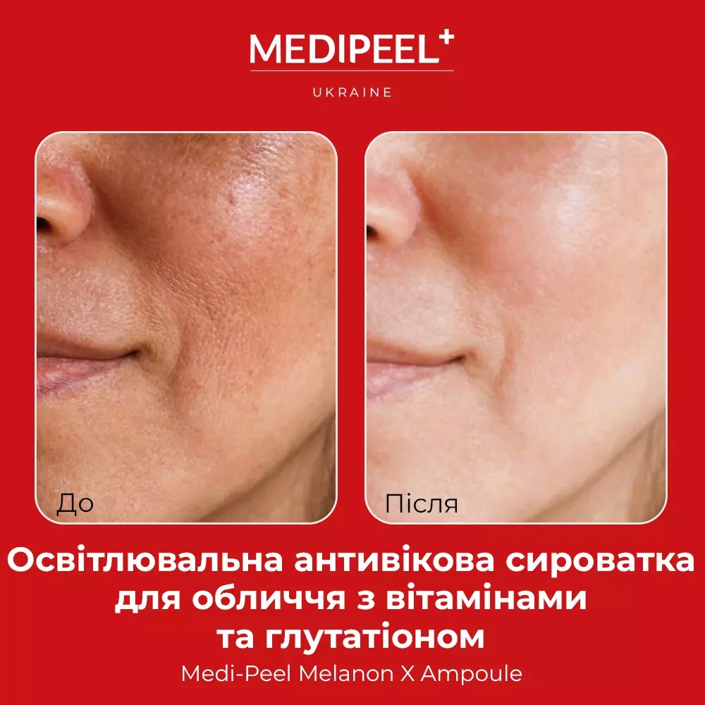 Сыворотка для лица Medi-Peel Melanon X Ampoule с витаминами и глутатионом осветительная 50 мл - фото 4