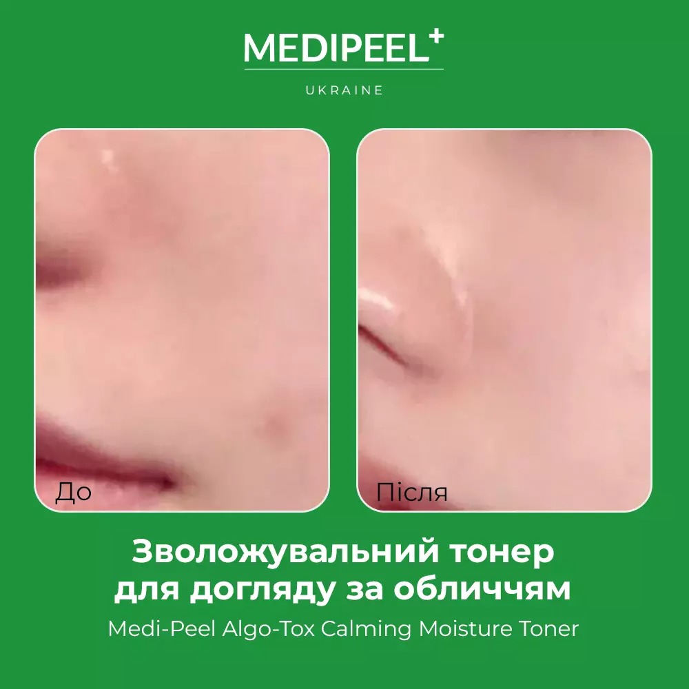 Тонер для обличчя Medi-Peel Algo-Tox Calming Moisture Toner зволожувальний 250 мл - фото 4