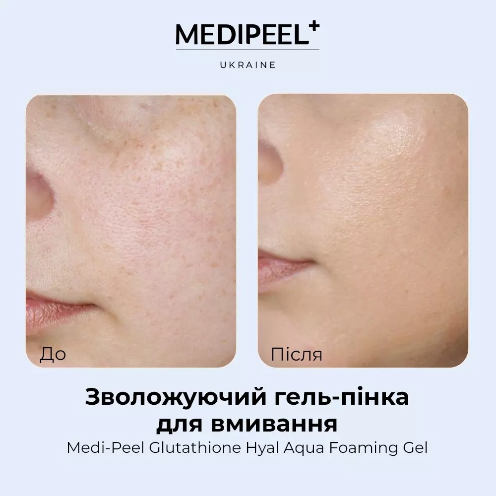 Гель-пенка для умывания Medi-Peel Glutathione Hyal Aqua Foaming Gel Cleanser увлажняющий 150 мл - фото 5