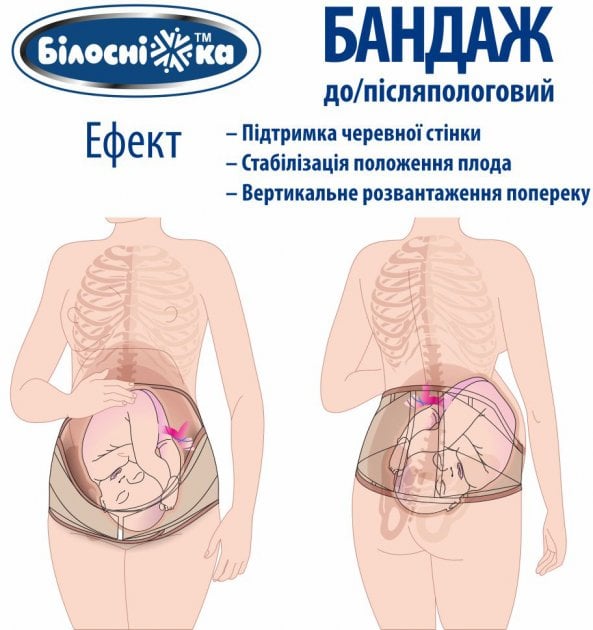 Бандаж до/післяродовий Білосніжка, р.2 (85-95 см), бежевый (411848) - фото 4