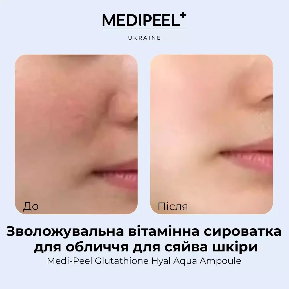 Сироватка для обличчя Medi-Peel Glutathione Hyal Aqua Ampoule зволожувальна вітамінна для сяйва шкіри 30 мл - фото 5