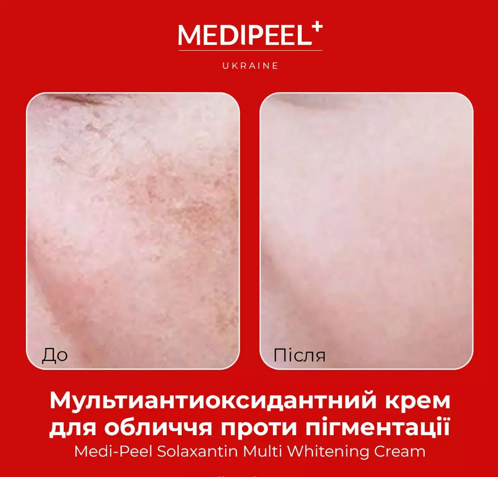 Крем для обличчя Medi-Peel Solaxantin Multi Whitening Cream мультиантиоксидантний проти пігментації 50 г - фото 4