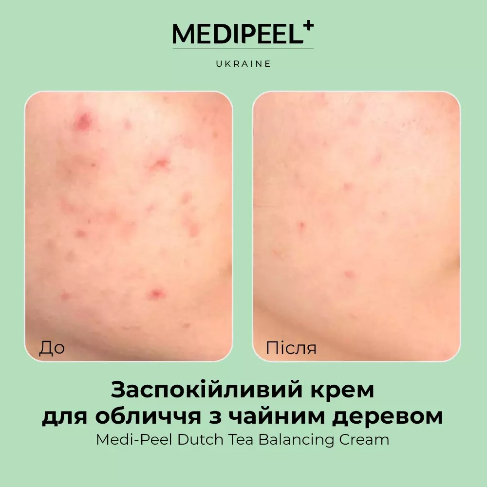 Крем для лица Medi-Peel Dutch Tea Balancing Cream успокаивающий с чайным деревом 70 мл - фото 4