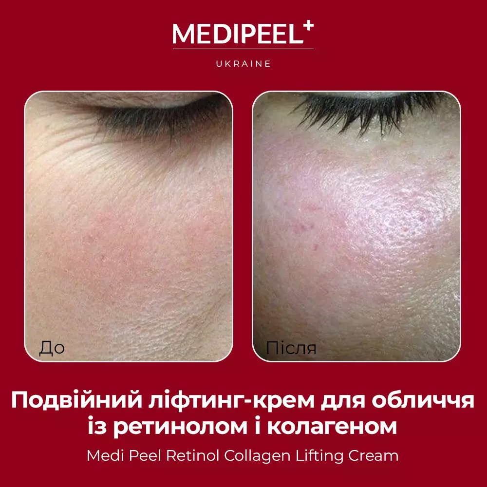 Подвійний ліфтинг-крем Medi-Peel Retinol Collagen Lifting Cream з ретинолом і колагеном 50 мл - фото 4