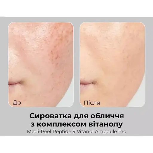 Сыворотка для лица Medi-Peel Peptide 9 Vitanol Ampoule Pro с пептидами и комплексом витанола 30 мл - фото 4