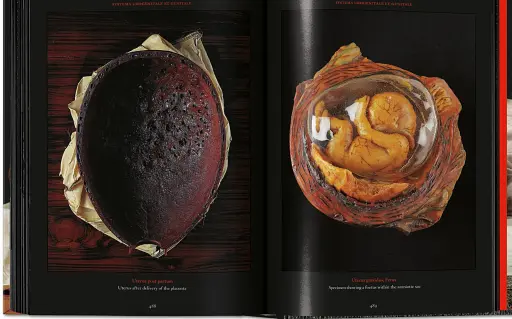 Anatomical Waxes. 45th Edition - фото 26