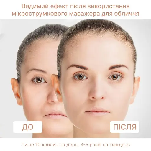 Мікрострум ліфтинг-массажер Medica+ Skin Lifting 6.0 White  - фото 3