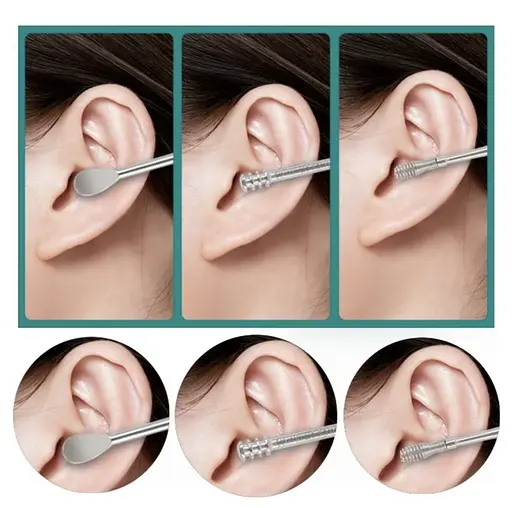 Набір для чищення вух і видалення вушної сірки із 6 інструментів Жовтий - фото 5