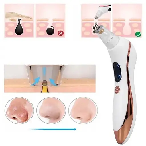 Очисник шкіри BS-810 від чорних цяток вакуумний - фото 5