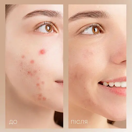 Скрабер ультразвуковой AIMED LED+EMS с функцией фототерапии и микротокового массажа цвет белый - фото 3