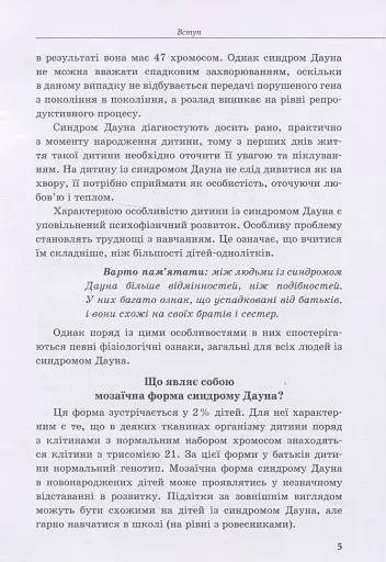 Дитина із синдромом Дауна - фото 4