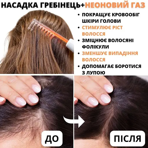 Дарсонваль AIMED Lift Skin Pro Black Edition с 6 насадками цвет черный - фото 8