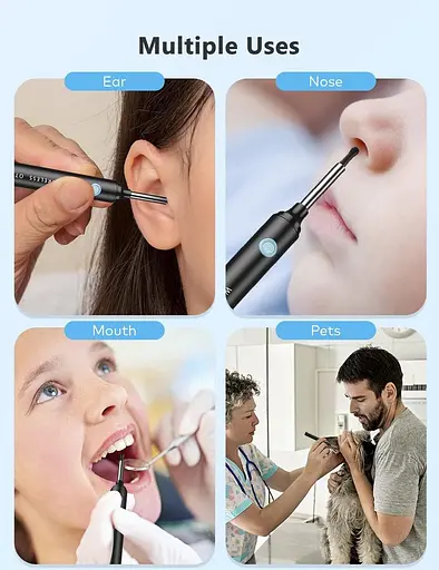 Набір для видалення вушної сірки Hopefox, камера для очищення вух, 5-мегапіксельна амера для вух із 6 світлодіодними лампами - фото 3