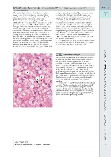 Wheater's Basic Pathology: A Text, Atlas, and Review of Histopathology. International Edition, 5th Edition - фото 10