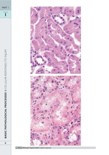 Wheater's Basic Pathology: A Text, Atlas, and Review of Histopathology. International Edition, 5th Edition - фото 9