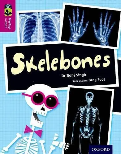 Oxford Reading Tree TreeTops inFact. Level 10: Skelebones