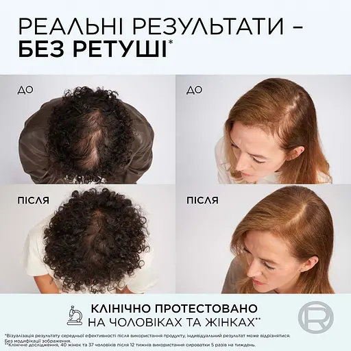 Шампунь L'Oreal Paris Elseve Growth Booster для боротьби з випадінням та ламкістю волосся 200 мл - фото 8