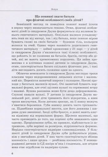 Дитина із синдромом Дауна - фото 5