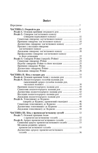 Біль в руках. Отерплість рук. Що потрібно знати про своє захворювання. - фото 8