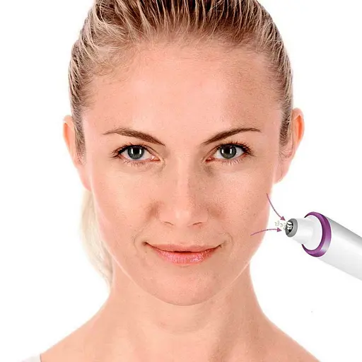 Прибор для очистки лица Beurer FC 76 (60658) [79709] - фото 5