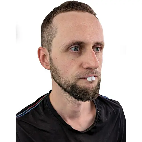 Зуби Кролик - фото 2