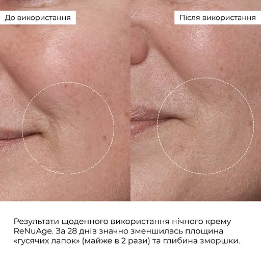 Ночной крем для антивозрастного ухода для всех типов кожи ReNuAge CollaGenious Plump Night Cream Hillary 50 мл - фото 9