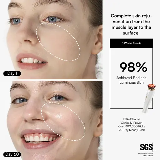 Микротоковое устройство для лица INIA FLARE - фото 3