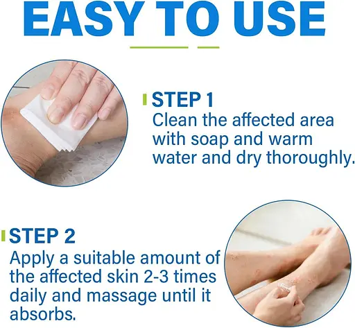 Противогрибковый крем, противогрибковый крем для кожи, противогрибковый крем от зуда для облегчения стригущего лишая и экземы - фото 7