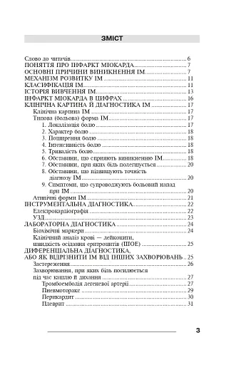 Інфаркт міокарда - фото 8