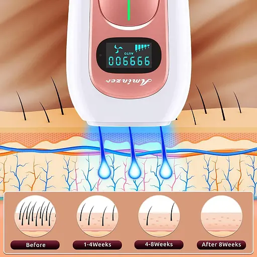 Пристрій для видалення волосся AMINZER IPL, лазерний 999 000 спалахів - фото 2