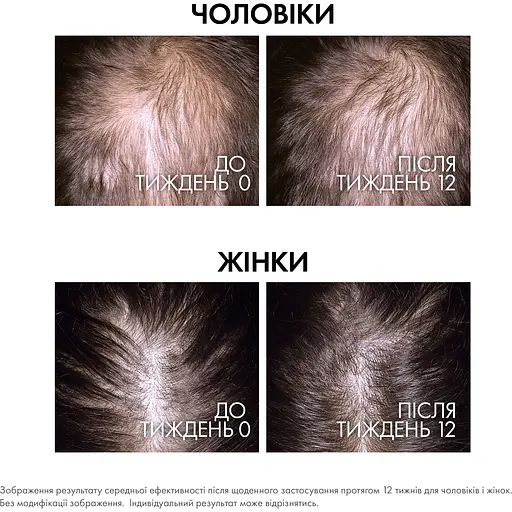 Сироватка Vichy Dercos Aminexil Clinical Regen Booster для відновлення густоти та боротьби з випадінням волосся 90 мл - фото 4