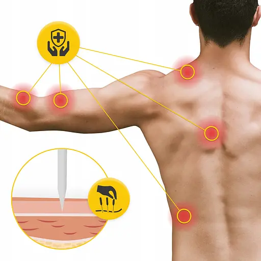 Иглы акупунктурные 4FIZJO 0.3 х 100 мм с направляющей 100 шт (P-5905973405102) - фото 8